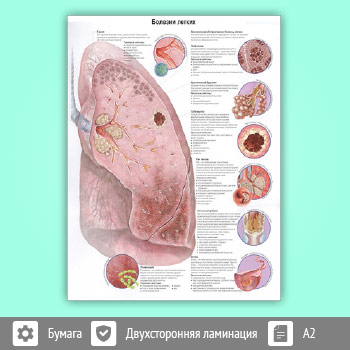 Плакат «Болезни легких» (ЗОЖ-09, 1 лист, A2)